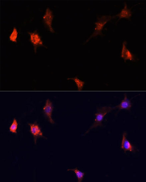 Cell Biology Antibodies 8 Anti-mTOR Antibody CAB2445