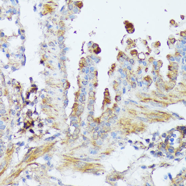 Metabolism Antibodies 2 Anti-WNT1 Antibody CAB2475