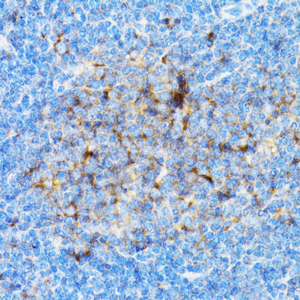 Cell Death Antibodies 1 Anti-SIAH1 Antibody CAB2494