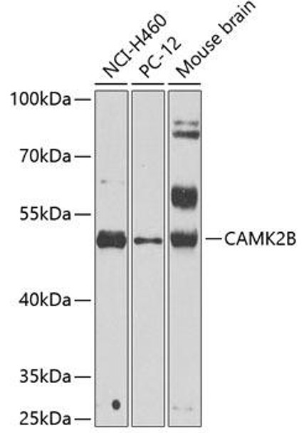 Developmental Biology Anti-CAMK2B Antibody CAB2508