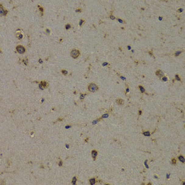 Metabolism Antibodies 2 Anti-EEF1D Antibody CAB2509