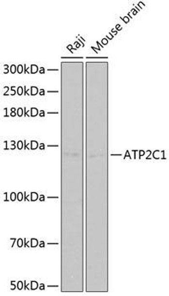 Cell Biology Antibodies 8 Anti-ATP2C1 Antibody CAB2515
