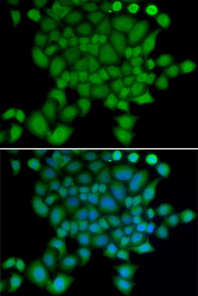 Cell Biology Antibodies 8 Anti-NEDD9 Antibody CAB2521