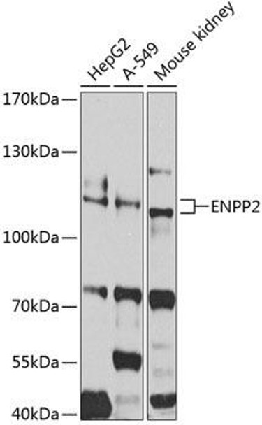 Cell Biology Antibodies 8 Anti-ENPP2 Antibody CAB2522