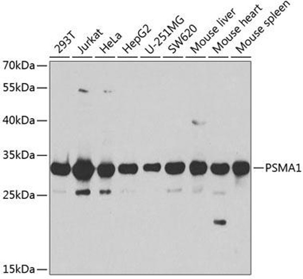 Immunology Antibodies 2 Anti-PSMA1 Antibody CAB2523