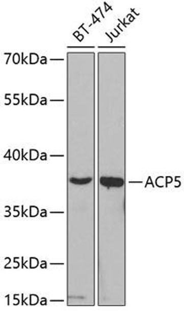 Cell Biology Antibodies 8 Anti-ACP5 Antibody CAB2528
