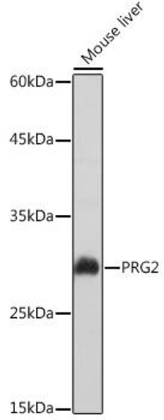 Immunology Antibodies 2 Anti-PRG2 Antibody CAB2532