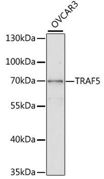 Cell Death Antibodies 1 Anti-TRAF5 Antibody CAB2536