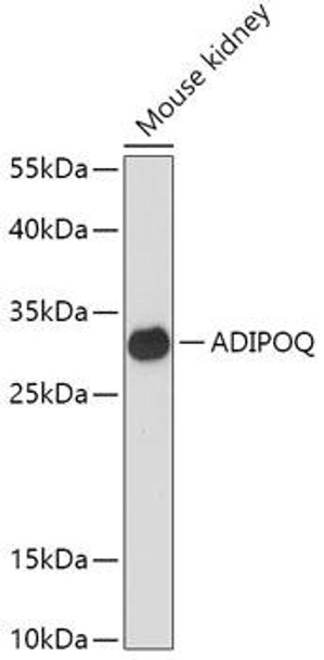 Cell Biology Antibodies 8 Anti-ADIPOQ Antibody CAB2543