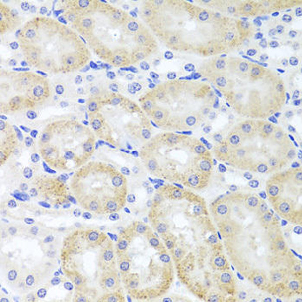 Cell Biology Antibodies 8 Anti-ADIPOQ Antibody CAB2543