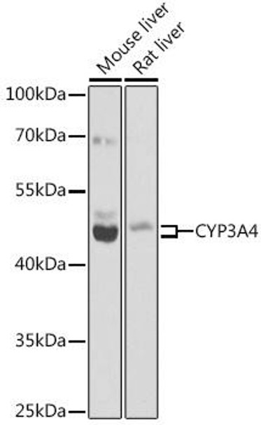 Metabolism Antibodies 2 Anti-CYP3A4 Antibody CAB2544