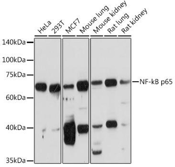 Immunology Antibodies 2 Anti-NF-kB p65 Antibody CAB2547