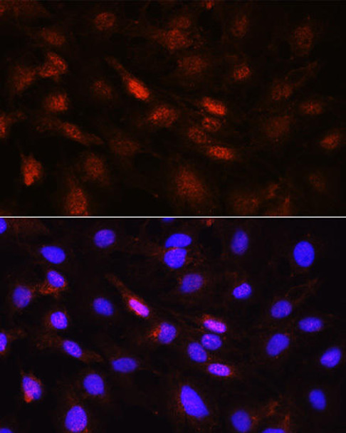 Cell Cycle Antibodies 1 Anti-PLK1 Antibody CAB2548