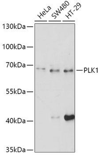 Cell Cycle Antibodies 1 Anti-PLK1 Antibody CAB2548