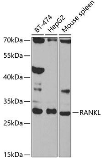 Developmental Biology Anti-RANKL Antibody CAB2550