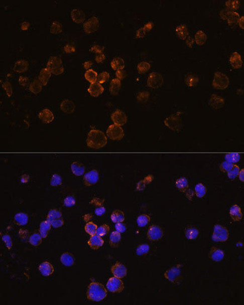 Developmental Biology Anti-RANKL Antibody CAB2550