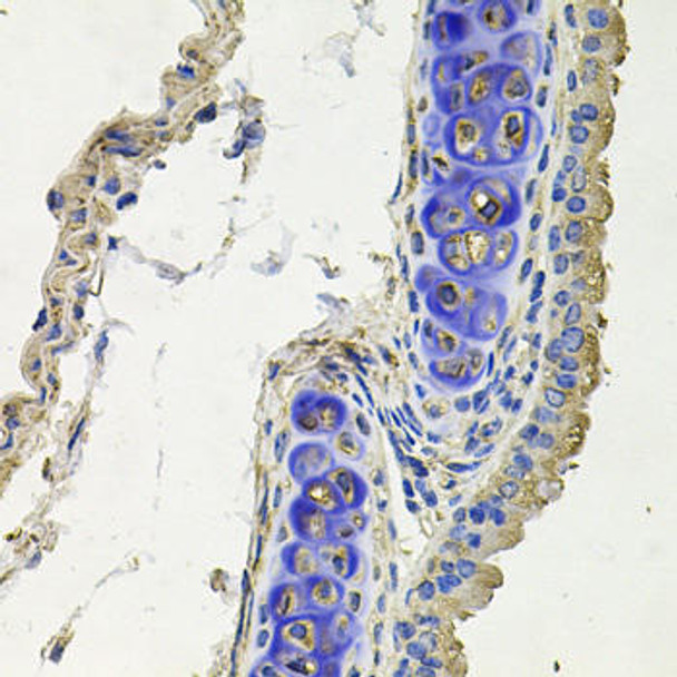 Immunology Antibodies 2 Anti-SKP1 Antibody CAB2566