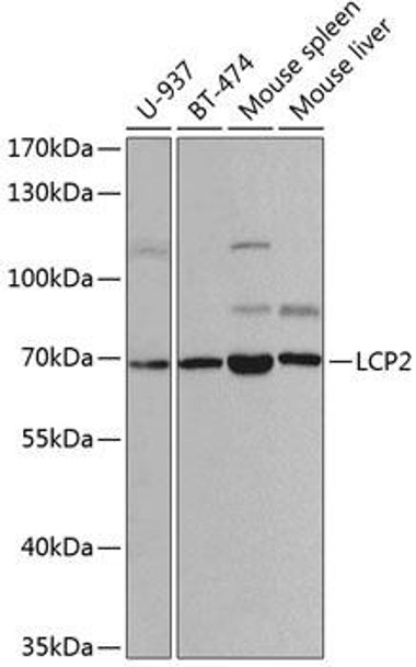 Cell Biology Antibodies 8 Anti-LCP2 Antibody CAB2567