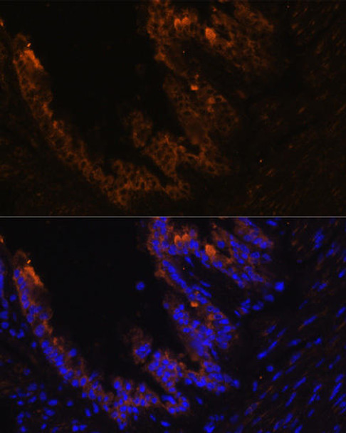 Immunology Antibodies 2 Anti-KRT7 Antibody CAB2574