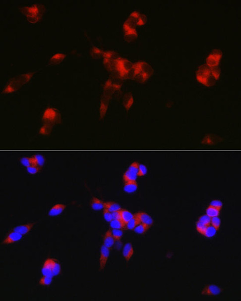 Cell Biology Antibodies 8 Anti-PPP1R1B Antibody CAB2580