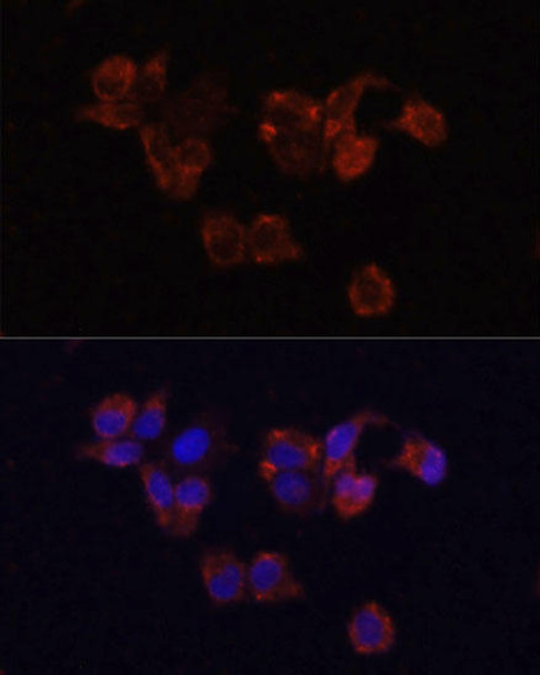 Immunology Antibodies 2 Anti-LAMP1 Antibody CAB2582