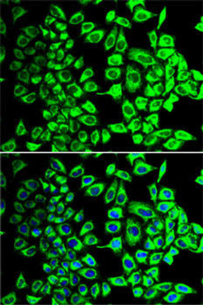 Cell Biology Antibodies 8 Anti-SDHA Antibody CAB2594