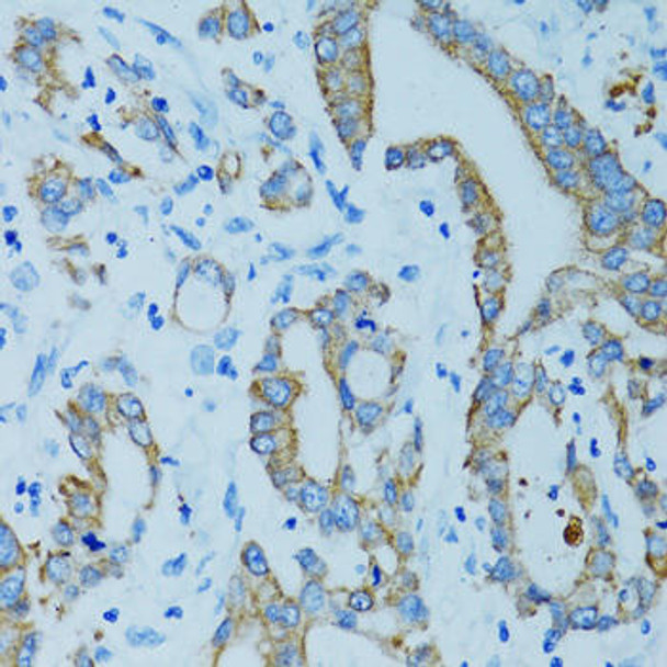 Cell Biology Antibodies 8 Anti-KRT15 Antibody CAB2660