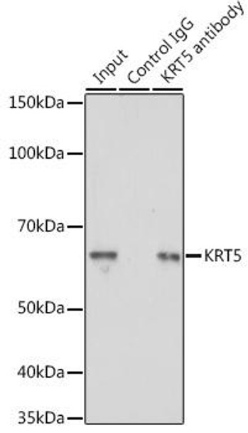 Cell Biology Antibodies 8 Anti-KRT5 Antibody CAB2662