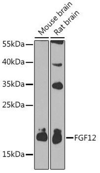 Cell Biology Antibodies 8 Anti-FGF12 Antibody CAB2667