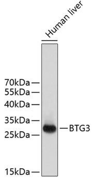 Cell Biology Antibodies 8 Anti-BTG3 Antibody CAB2669