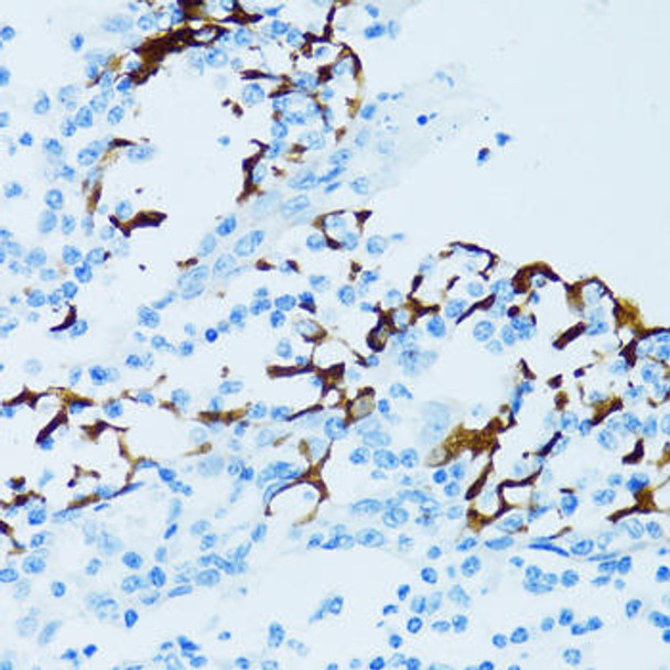 Cell Biology Antibodies 8 Anti-CTSE Antibody CAB2678