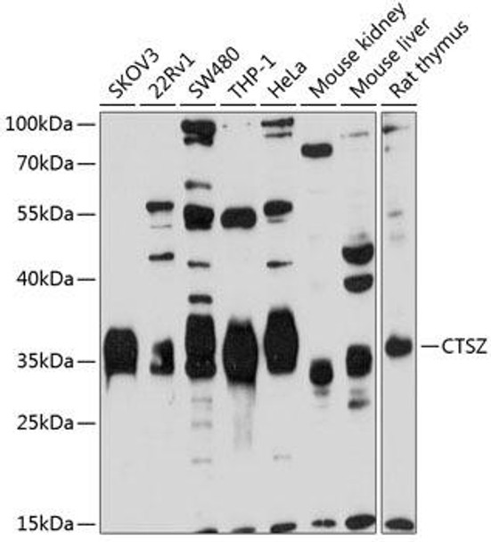 Cell Biology Antibodies 8 Anti-CTSZ Antibody CAB2681