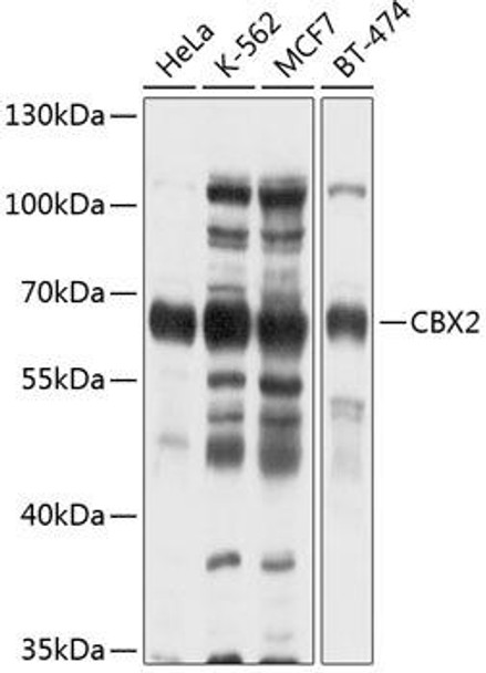 Developmental Biology Anti-CBX2 Antibody CAB2683