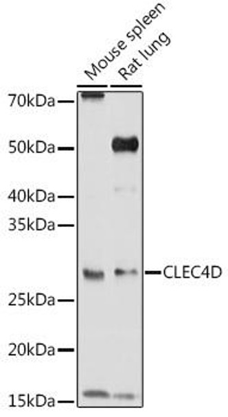 Immunology Antibodies 2 Anti-CLEC4D Antibody CAB2697