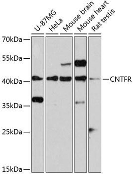 Cell Biology Antibodies 8 Anti-CNTFR Antibody CAB2700
