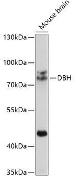 Metabolism Antibodies 2 Anti-DBH Antibody CAB2711