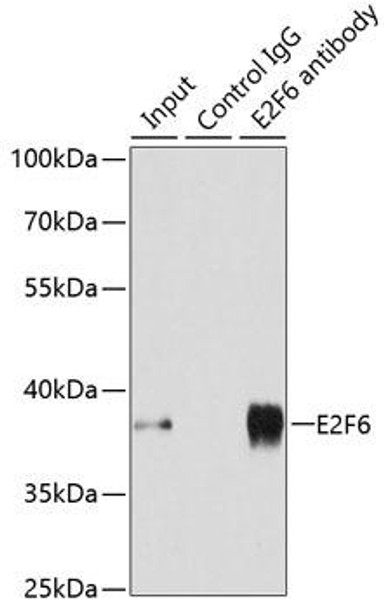 Cell Cycle Antibodies 1 Anti-E2F6 Antibody CAB2718