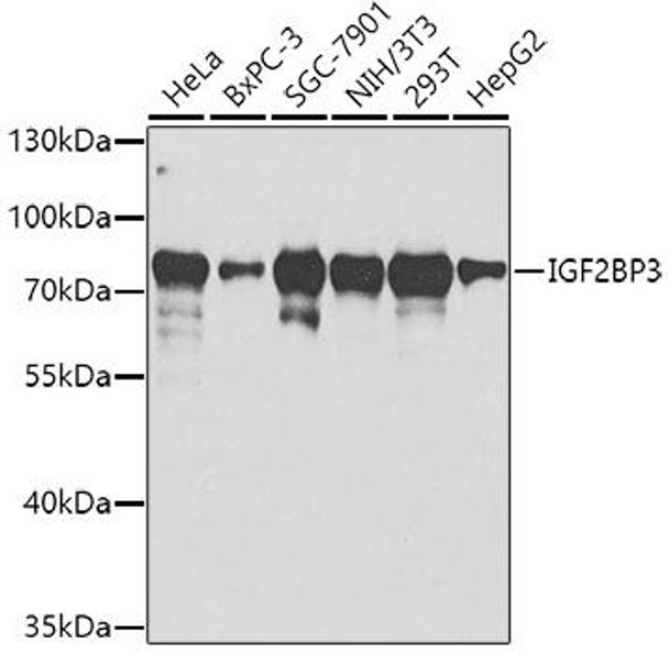 Epigenetics and Nuclear Signaling Antibodies 3 Anti-IGF2BP3 Antibody CAB2750