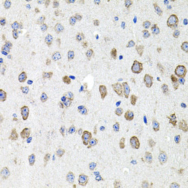 Cell Biology Antibodies 8 Anti-CDH23 Antibody CAB2785