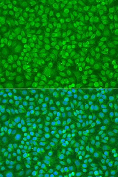 Cell Biology Antibodies 8 Anti-PTPN11 Antibody CAB2793