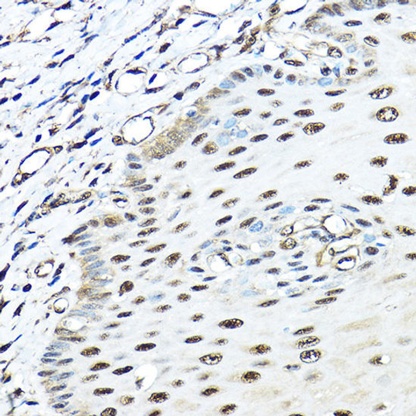 Autophagy Antibodies Anti-VCP Antibody CAB2795