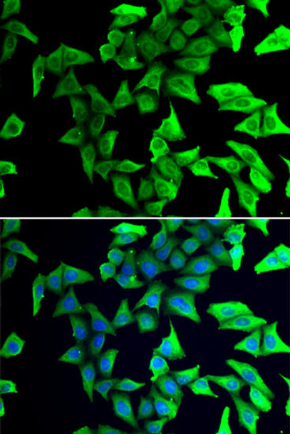 Cell Biology Antibodies 8 Anti-VSNL1 Antibody CAB2797