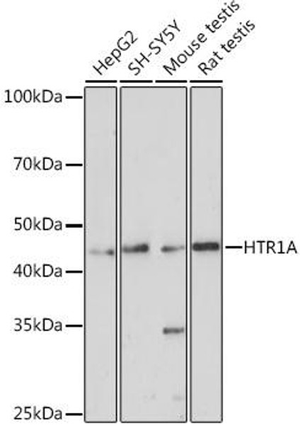 Developmental Biology Anti-HTR1A Antibody CAB2801