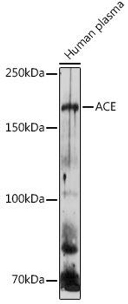 Cell Biology Antibodies 8 Anti-ACE Antibody CAB2805