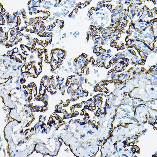 Cell Biology Antibodies 8 Anti-ACE Antibody CAB2805