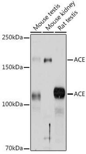 Cell Biology Antibodies 8 Anti-ACE Antibody CAB2805