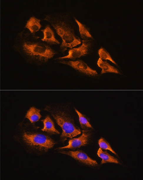 Cell Biology Antibodies 8 Anti-ADRA2A Antibody CAB2809