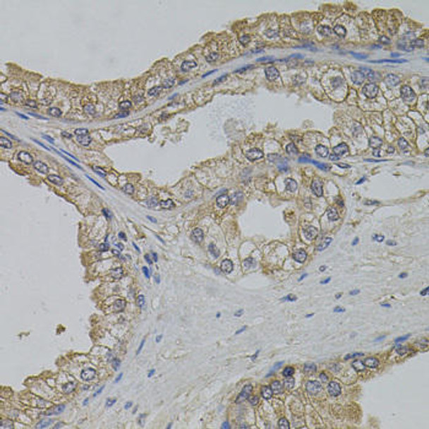 Cell Biology Antibodies 8 Anti-ARF1 Antibody CAB2821