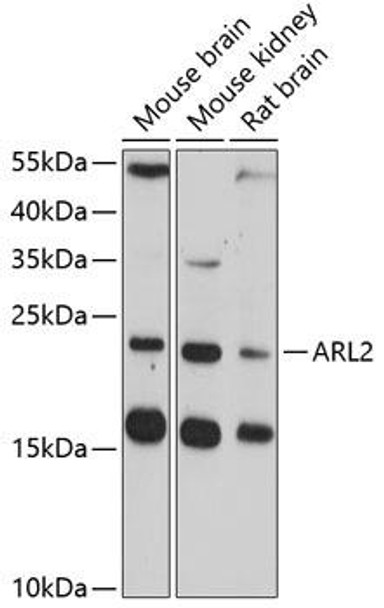 Cell Cycle Antibodies 1 Anti-ARL2 Antibody CAB2830
