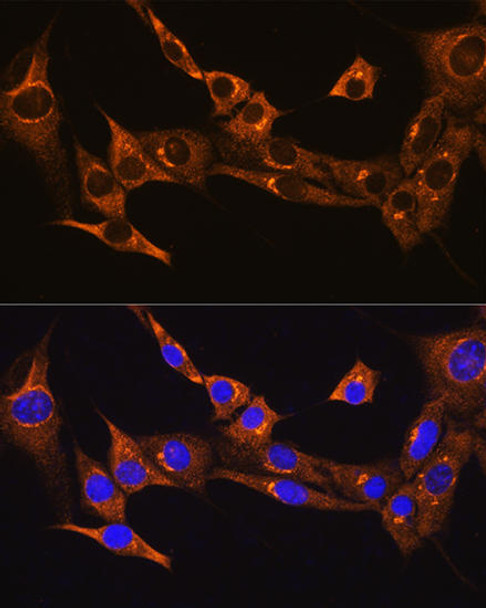 Cell Biology Antibodies 8 Anti-BDKRB2 Antibody CAB2844